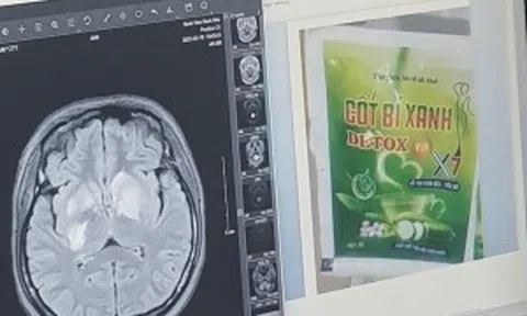 Cảnh báo không uống cốt bí xanh theo Tiktok